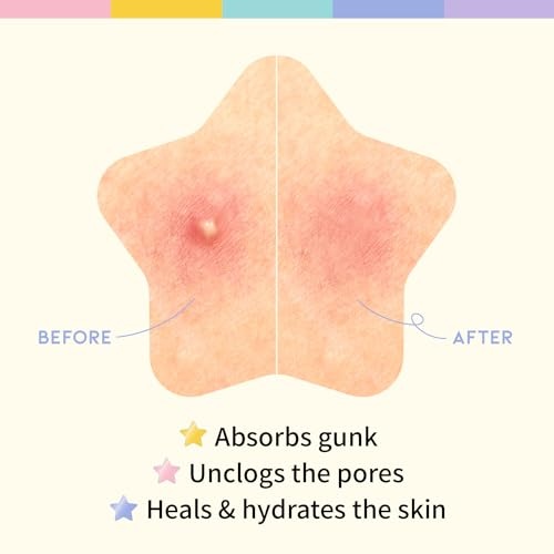 OOTD - Star Spot Patch - 16pcs*5ea