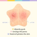 OOTD - Star Spot Patch - 16pcs*5ea