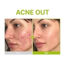 Purito SEOUL - Azelaic Acid 10 Kojic Tea Tree Serum - 30ml