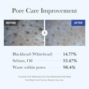 Medicube - Zero Pore Blackhead Mud Mask - 100g