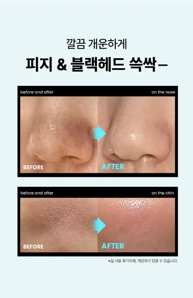 ILSO_Super_Melting_Sebum_Softener_150ml3.webp