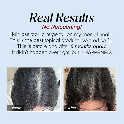 Seapuri Scalpy Hair Serum (20ml)