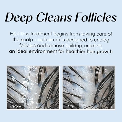 Seapuri Scalpy Hair Serum (20ml)