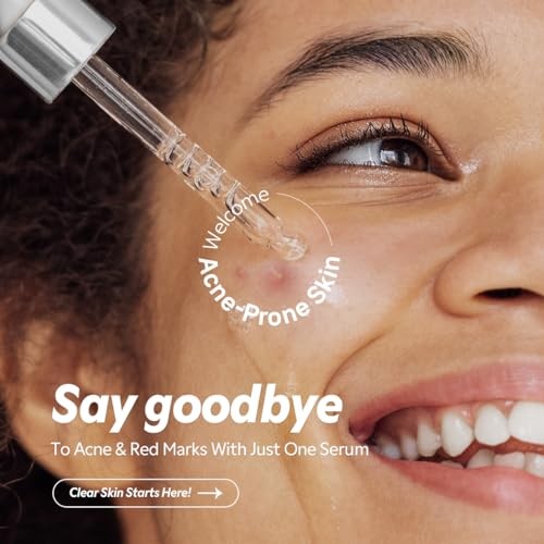 TIRTIR Azelaic Acid 12% Serum for Blemish-Prone Skin - Lightweight Hydrating Formula with Zinc PCA & Hyal-ZIP, Non-Comedogenic, Fragrance-Free, 30ml /