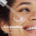 TIRTIR Azelaic Acid 12% Serum for Blemish-Prone Skin - Lightweight Hydrating Formula with Zinc PCA & Hyal-ZIP, Non-Comedogenic, Fragrance-Free, 30ml /