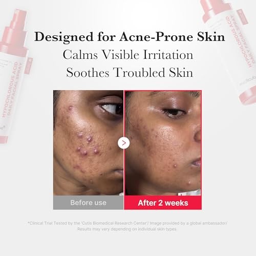 Medicube - Hypochlorous Acid Daily Facial Spray - 125ml