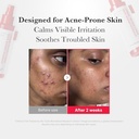 Medicube - Hypochlorous Acid Daily Facial Spray - 125ml