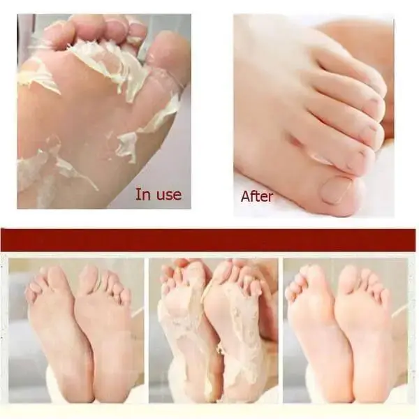 A_Pieu-Soft-Foot-30-Minute-Peeling-nap-beauty-2.webp